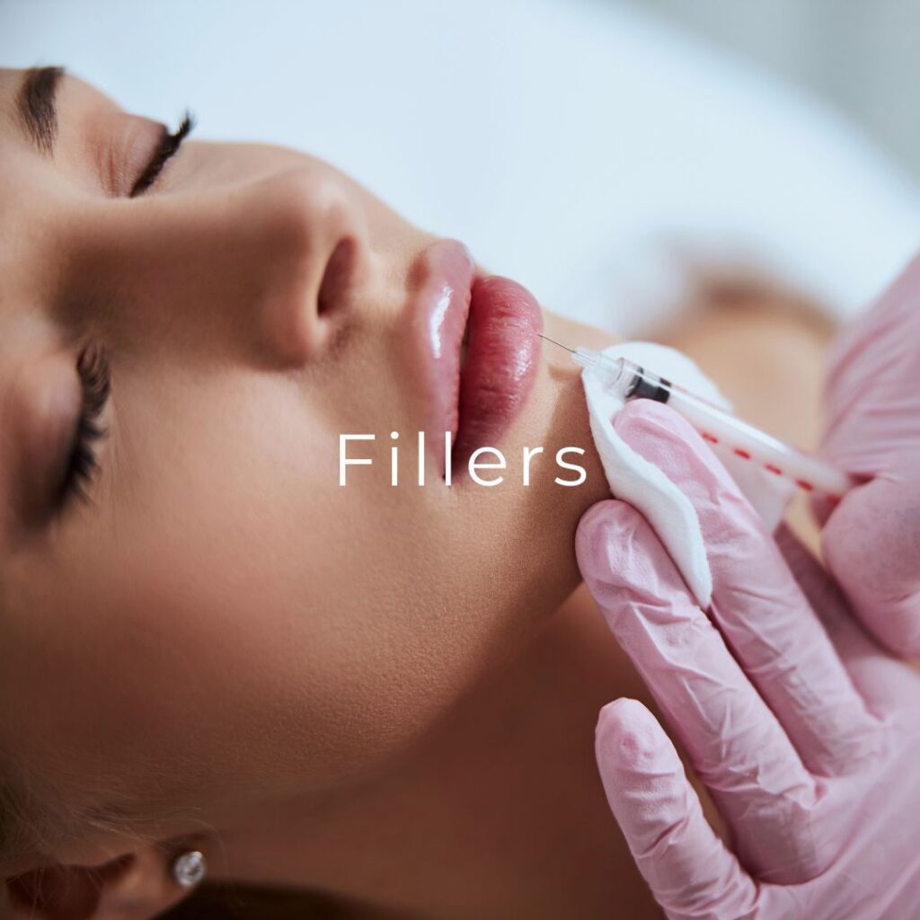 Fillers SkinClub smukke læber