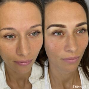 Permanent makeup bryn Kolding Düwald SkinClub