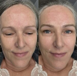 Permanent makeup bryn Kolding Düwald SkinClub