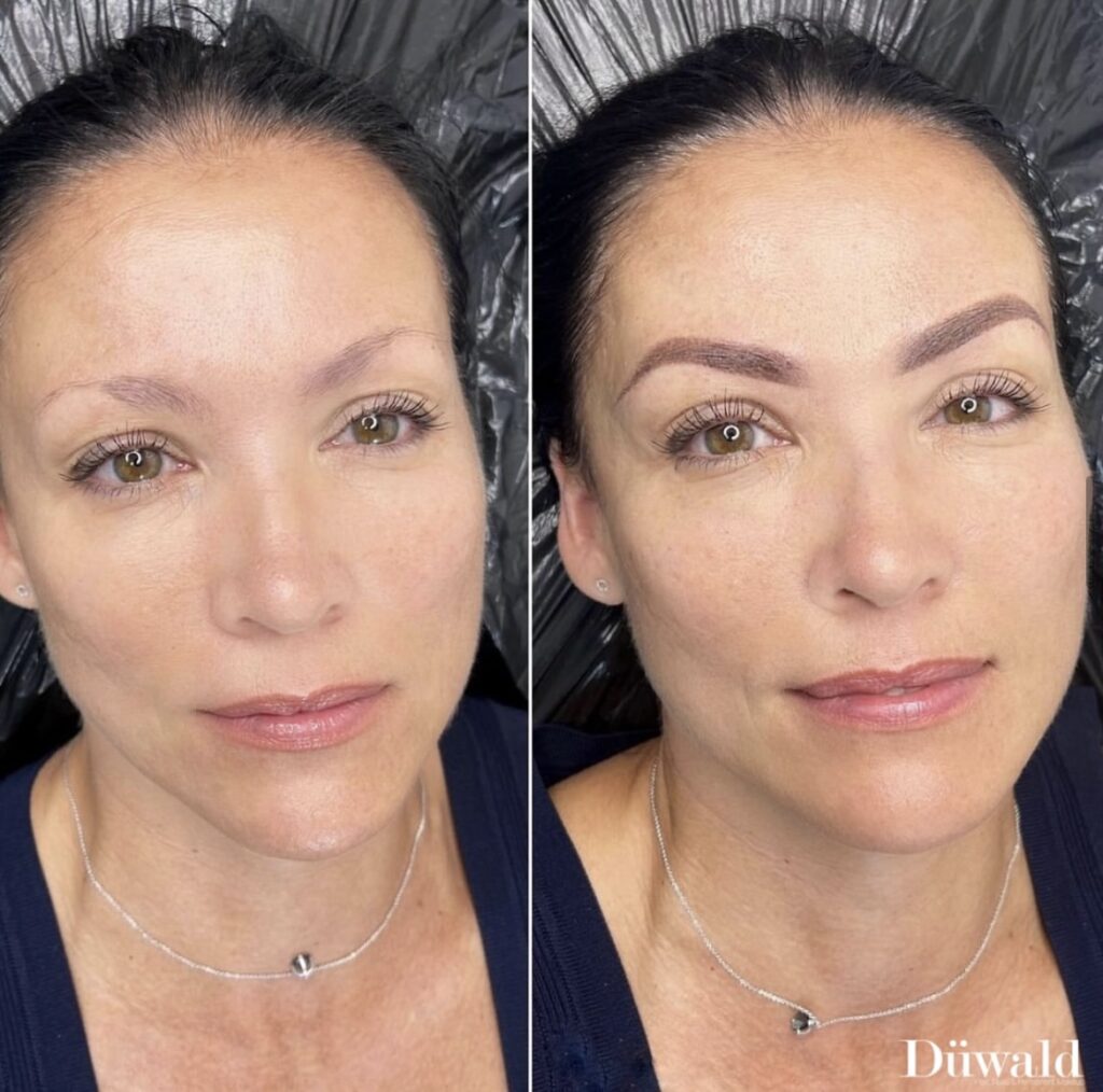 Permanent makeup bryn Kolding Düwald SkinClub