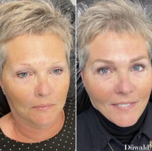 Permanent makeup bryn Kolding Düwald SkinClub