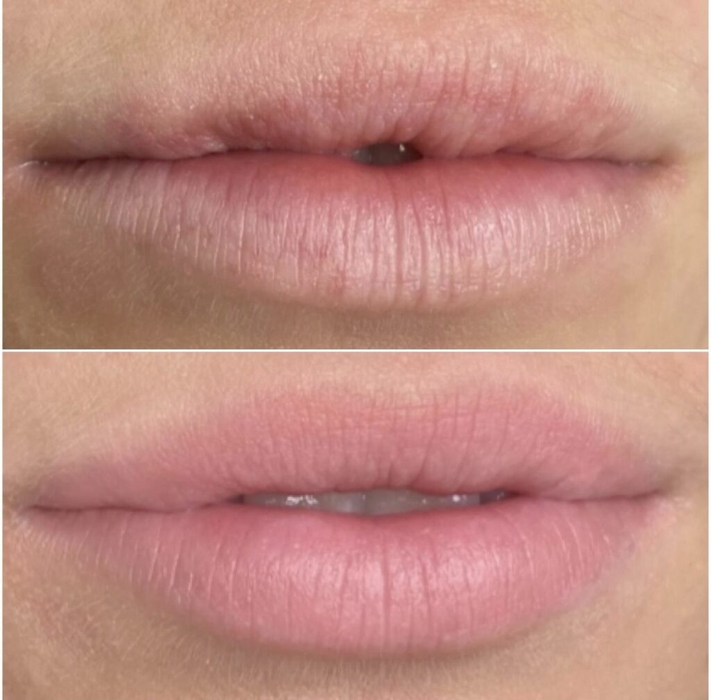 Permanent Make up Læber Kolding Düwald SkinClub